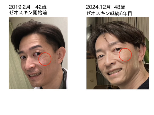 耳鼻咽喉科　雑誌　44冊セット　バラ売り応相談 耳鼻咽喉科・頭頸部外科 2023年 4月号 増刊号 豊富な処方例で